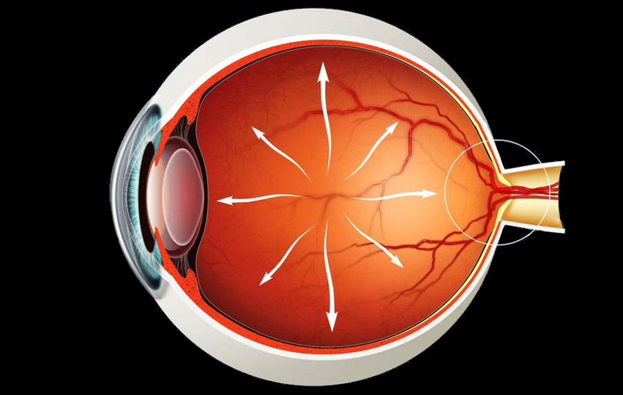 В каком возрасте возникает глаукома