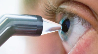 Пахиметрия глаза