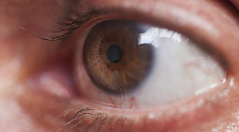 Причины возникновения вторичной глаукомы